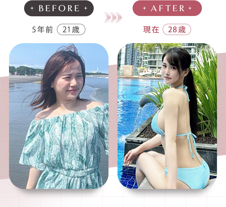 5年前（当時21歳の嬉野ゆみ）と現在（28歳の嬉野ゆみ）の比較画像